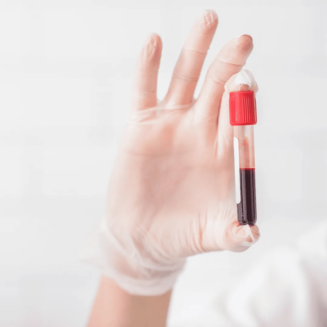 bloodtest bloodtest